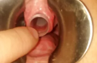 XXX Hundar börjar gratis amatörsex från din röv skit